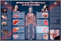 Электрифицированный стенд "Вредные привычки: алкоголизм" - «globural.ru» - Можайск