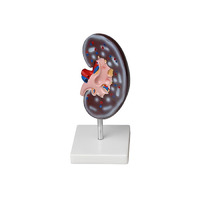 Модель почки в разрезе - «globural.ru» - Можайск