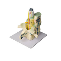 Модель части позвоночника человека - «globural.ru» - Можайск