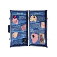 Учебно-демонстрационный кейс "Последствия употребления наркотиков" - «globural.ru» - Можайск