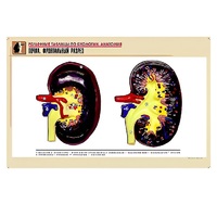 Рельефная таблица "Почка. Фронтальный разрез" (формат А1, матовое ламинир.) - «globural.ru» - Можайск