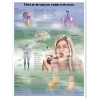 Плакат "Никотиновая зависимость", ламинированный, 50*67 см - «globural.ru» - Можайск
