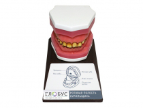 Демонстрационная модель "Ротовая полость курильщика" - «globural.ru» - Можайск